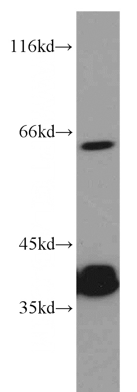 HepG2 cells were subjected to SDS PAGE followed by western blot with Catalog No:114010(PLS3 antibody) at dilution of 1:500