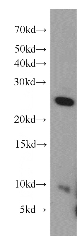 mouse thymus tissue were subjected to SDS PAGE followed by western blot with Catalog No:110641(FGFR1OP2 antibody) at dilution of 1:500
