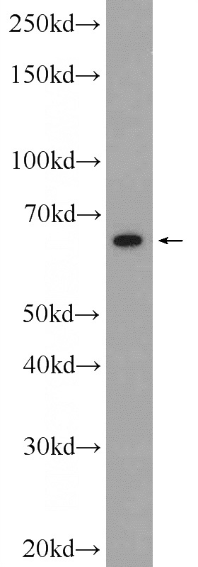 HUVEC cells were subjected to SDS PAGE followed by western blot with Catalog No:115347(SLC6A8 Antibody) at dilution of 1:600
