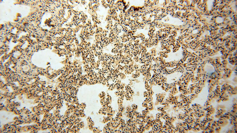 Immunohistochemical of paraffin-embedded human lung using Catalog No:110755(FXYD3 antibody) at dilution of 1:100 (under 10x lens)