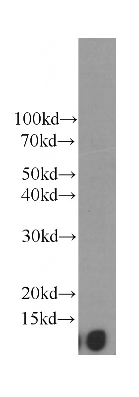 Raji cells were subjected to SDS PAGE followed by western blot with Catalog No:107076(B2M Antibody) at dilution of 1:4000