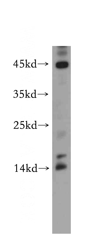 HeLa cells were subjected to SDS PAGE followed by western blot with Catalog No:108639(C11orf51 antibody) at dilution of 1:300
