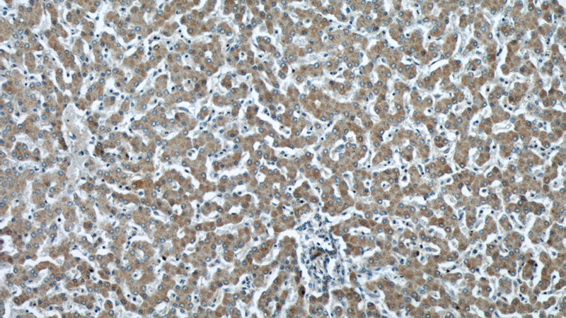 Immunohistochemical of paraffin-embedded human liver using Catalog No:109234(CHMP2B antibody) at dilution of 1:50 (under 10x lens)