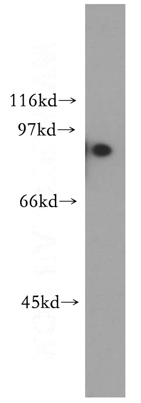 PC-3 cells were subjected to SDS PAGE followed by western blot with Catalog No:116313(TRIM37 antibody) at dilution of 1:300