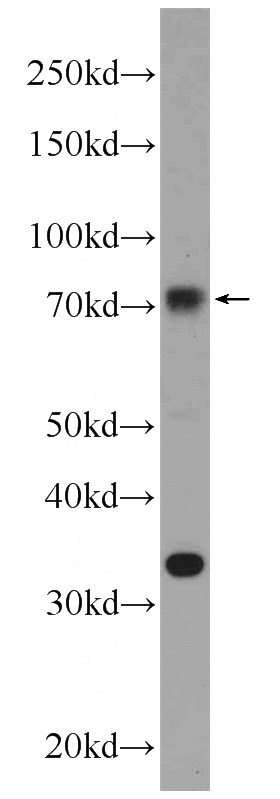 NIH/3T3 cells were subjected to SDS PAGE followed by western blot with Catalog No:113229(NR1D1 Antibody) at dilution of 1:1000