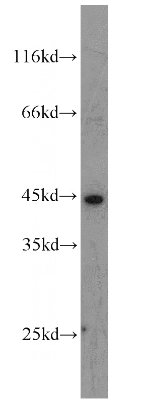 HepG2 cells were subjected to SDS PAGE followed by western blot with Catalog No:110195(EIF3G antibody) at dilution of 1:500