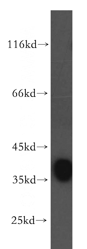 human brain tissue were subjected to SDS PAGE followed by western blot with Catalog No:110988(GNAI2 antibody) at dilution of 1:800