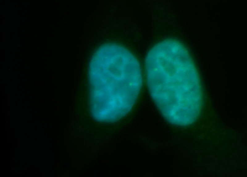Immunofluorescent analysis of HepG2 cells, using RECQL5 antibody Catalog No:114677 at 1:100 dilution and FITC-labeled donkey anti-rabbit IgG(green). Blue pseudocolor = DAPI (fluorescent DNA dye).