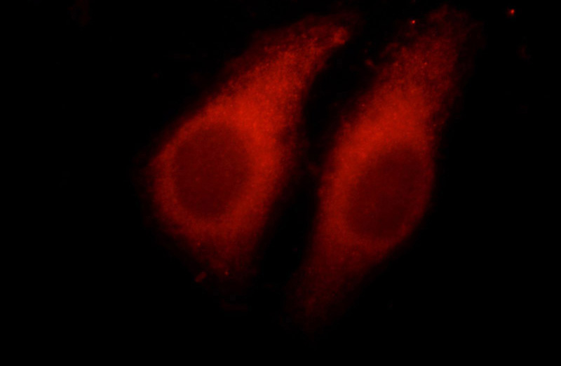 Immunofluorescent analysis of HepG2 cells, using BCR antibody Catalog No:117109 at 1:50 dilution and Rhodamine-labeled goat anti-rabbit IgG (red).
