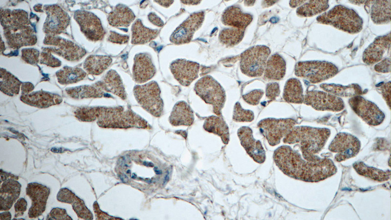 Immunohistochemistry of paraffin-embedded human heart tissue slide using Catalog No:112935(MYH6 Antibody) at dilution of 1:50 (under 40x lens)
