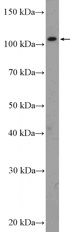Jurkat cells were subjected to SDS PAGE followed by western blot with Catalog No:115131(SETDB2 Antibody) at dilution of 1:300
