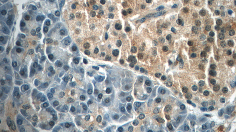 Immunohistochemistry of paraffin-embedded human pancreas tissue slide using Catalog No:110746(FOXA2 Antibody) at dilution of 1:50 (under 40x lens)