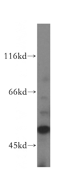 K-562 cells were subjected to SDS PAGE followed by western blot with Catalog No:114192(PRIM1 antibody) at dilution of 1:500