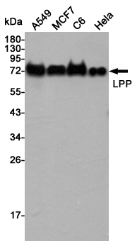 Western blot detection of LPP in A549,MCF7,C6 and Hela cell lysates using LPP mouse mAb (1:5000 diluted).Predicted band size:66KDa.Observed band size:75KDa.