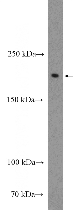 rat brain tissue were subjected to SDS PAGE followed by western blot with Catalog No:113127(NFASC Antibody) at dilution of 1:300