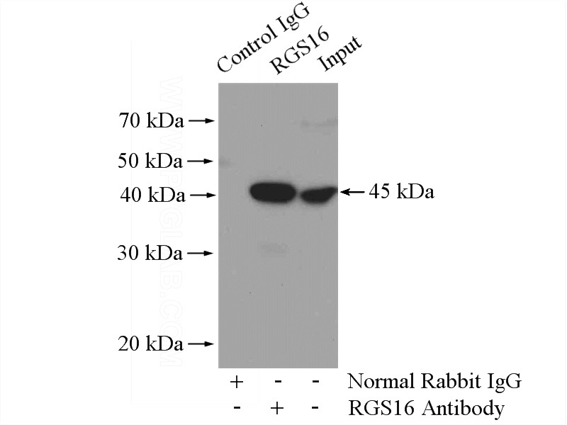 IP Result of anti-RGS16 (IP:Catalog No:114643, 4ug; Detection:Catalog No:114643 1:300) with HepG2 cells lysate 3200ug.