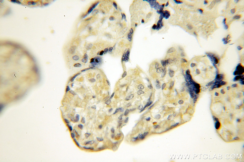 Immunohistochemical of paraffin-embedded human placenta using Catalog No:108836(CAPN6 antibody) at dilution of 1:50 (under 40x lens)
