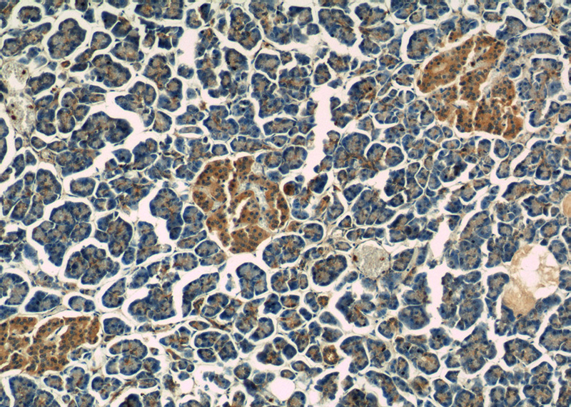 Immunohistochemistry of paraffin-embedded human pancreas tissue slide using Catalog No:114547(RAP1GAP Antibody) at dilution of 1:50 (under 10x lens)