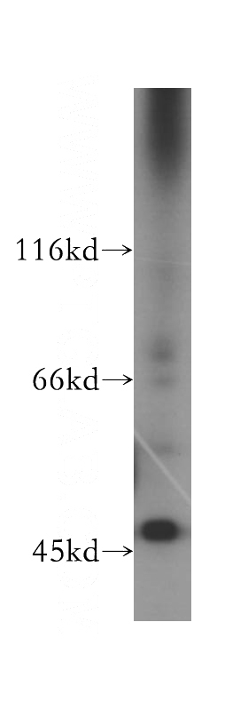 Jurkat cells were subjected to SDS PAGE followed by western blot with Catalog No:110974(GIMAP5 antibody) at dilution of 1:500