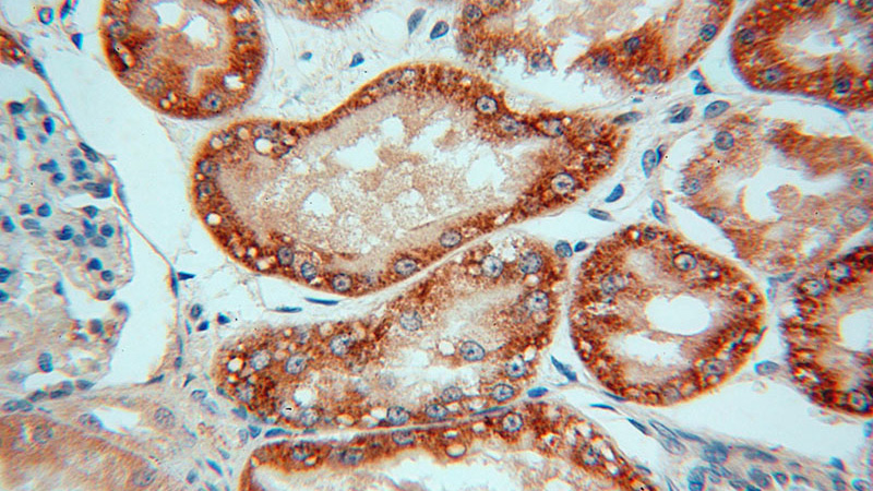 Immunohistochemical of paraffin-embedded human kidney using Catalog No:113066(NDUFAF1 antibody) at dilution of 1:50 (under 40x lens)
