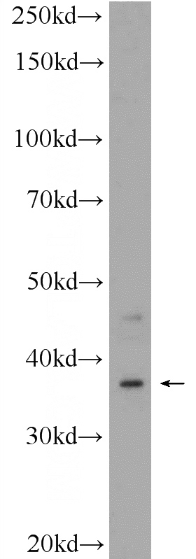 HepG2 cells were subjected to SDS PAGE followed by western blot with Catalog No:108698(C20orf195 Antibody) at dilution of 1:300