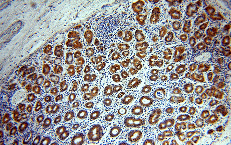 Immunohistochemical of paraffin-embedded human stomach using Catalog No:109215(CHCHD6 antibody) at dilution of 1:100 (under 10x lens)