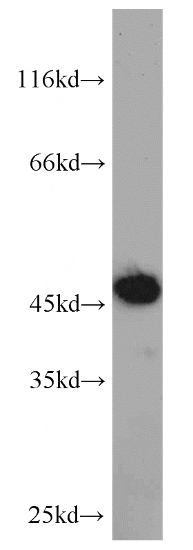 K-562 cells were subjected to SDS PAGE followed by western blot with Catalog No:110360(ERI1 antibody) at dilution of 1:1000