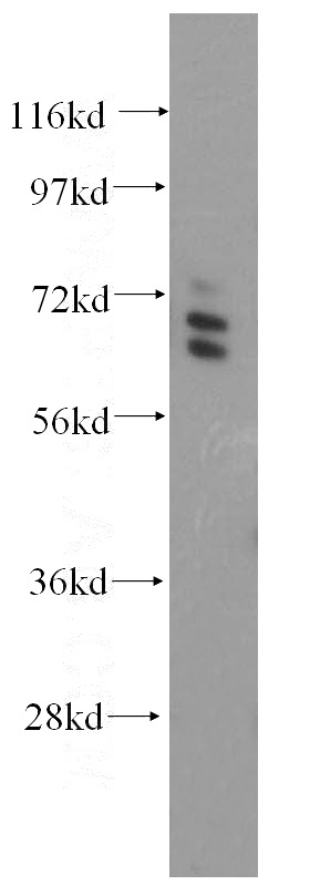 HeLa cells were subjected to SDS PAGE followed by western blot with Catalog No:108179(ARHGAP9 antibody) at dilution of 1:1000