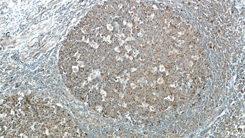 Immunohistochemical of paraffin-embedded human tonsil using Catalog No:110550(FBXO22 antibody) at dilution of 1:50 (under 10x lens)
