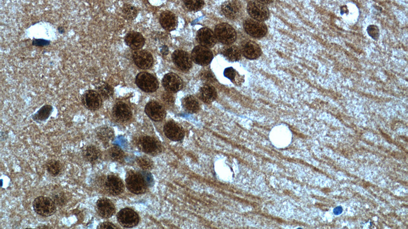 Immunohistochemistry of paraffin-embedded mouse brain tissue slide using Catalog No:111381(HDAC6-speciifc Antibody) at dilution of 1:50 (under 40x lens)