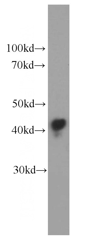 human blood tissue were subjected to SDS PAGE followed by western blot with Catalog No:107065(APOL1 antibody) at dilution of 1:20000