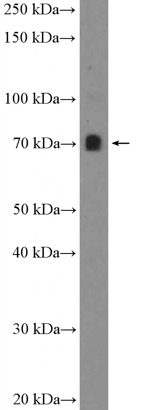 mouse spleen tissue were subjected to SDS PAGE followed by western blot with Catalog No:113602(PATZ1 Antibody) at dilution of 1:1000