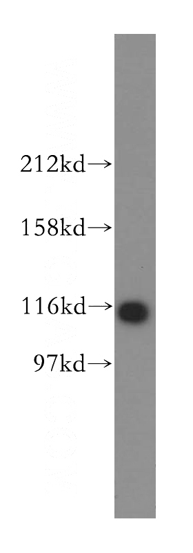 mouse kidney tissue were subjected to SDS PAGE followed by western blot with Catalog No:113332(OGDHL antibody) at dilution of 1:500