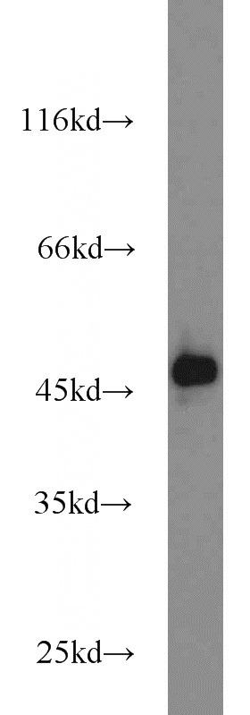 HeLa cells were subjected to SDS PAGE followed by western blot with Catalog No:116063(M6PRBP1 antibody) at dilution of 1:1000