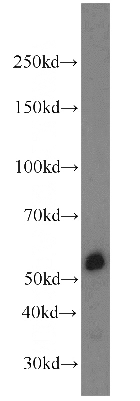 K-562 cells were subjected to SDS PAGE followed by western blot with Catalog No:114400(PSMD4 antibody) at dilution of 1:3000