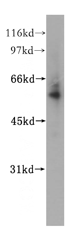 human liver tissue were subjected to SDS PAGE followed by western blot with Catalog No:107876(SERPINF2 antibody) at dilution of 1:500