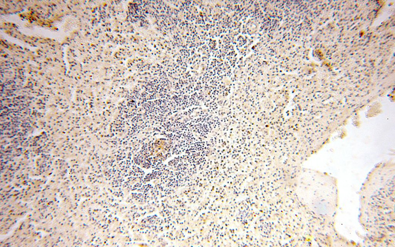 Immunohistochemical of paraffin-embedded human spleen using Catalog No:116573(UNC13D antibody) at dilution of 1:100 (under 10x lens)