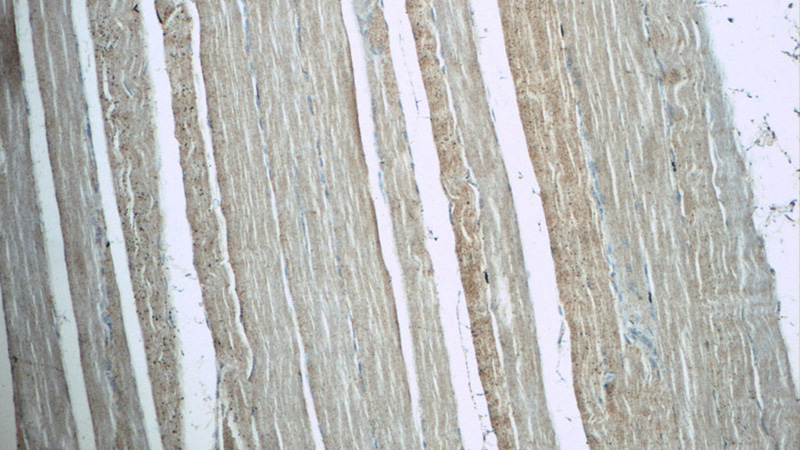 Immunohistochemistry of paraffin-embedded human skeletal muscle tissue slide using Catalog No:108133(ANAPC11 Antibody) at dilution of 1:50(under 10x lens)