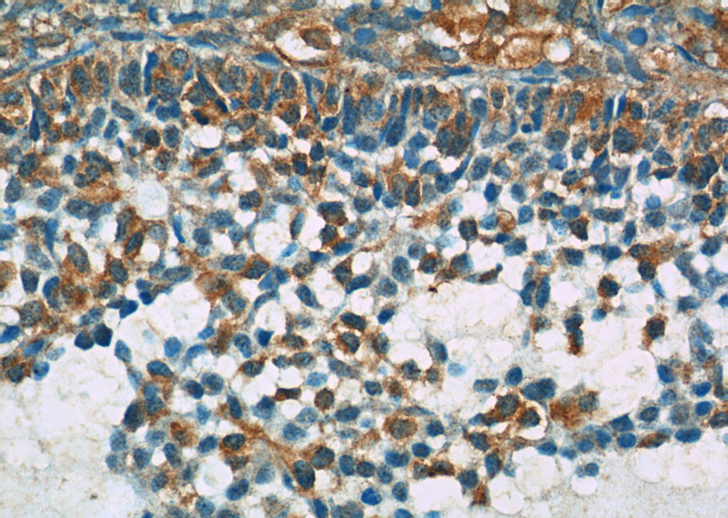 Immunohistochemistry of paraffin-embedded human ovary tissue slide using Catalog No:117151(BIVM Antibody) at dilution of 1:50 (under 40x lens)