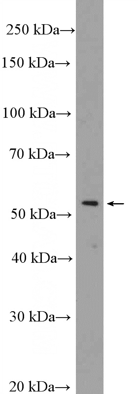 HeLa cells were subjected to SDS PAGE followed by western blot with Catalog No:109833(DDX49 Antibody) at dilution of 1:600