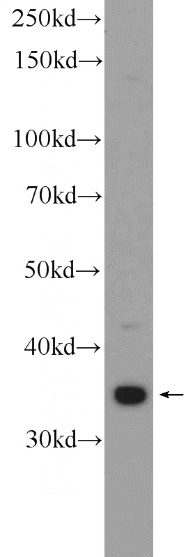 HeLa cells were subjected to SDS PAGE followed by western blot with Catalog No:116038(THAP10 Antibody) at dilution of 1:300