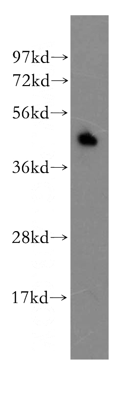 human spleen tissue were subjected to SDS PAGE followed by western blot with Catalog No:110347(PRocR antibody) at dilution of 1:400