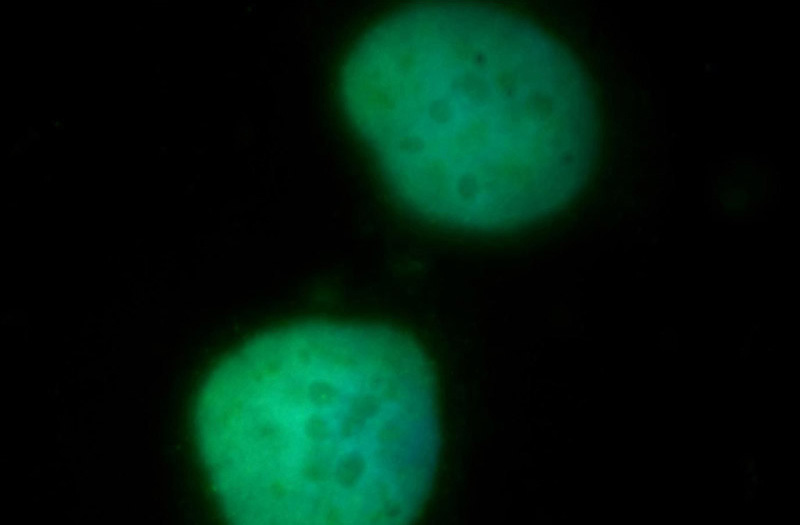 Immunofluorescent analysis of MCF-7 cells, using DHX16 antibody Catalog No:109928 at 1:50 dilution and FITC-labeled donkey anti-rabbit IgG(green). Blue pseudocolor = DAPI (fluorescent DNA dye).