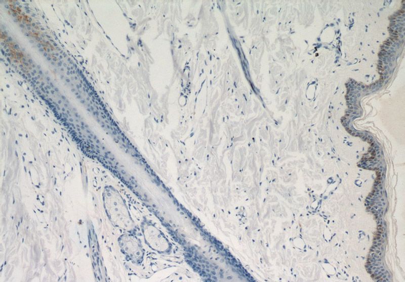 Immunohistochemical of paraffin-embedded human skin using Catalog No:112170(LCE1B antibody) at dilution of 1:50 (under 10x lens)