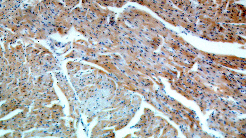 Immunohistochemical of paraffin-embedded human heart using Catalog No:108024(APOBEC2 antibody) at dilution of 1:100 (under 10x lens)