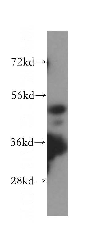 HL-60 cells were subjected to SDS PAGE followed by western blot with Catalog No:111376(HDAC3-specific antibody) at dilution of 1:200