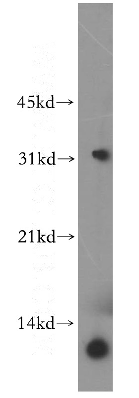 A549 cells were subjected to SDS PAGE followed by western blot with Catalog No:112627(MIP­3β antibody) at dilution of 1:500