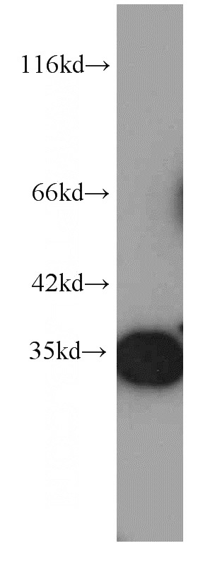 human brain tissue were subjected to SDS PAGE followed by western blot with Catalog No:107510(RPS3 antibody) at dilution of 1:1000