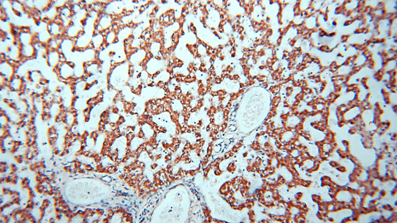 Immunohistochemical of paraffin-embedded human liver using Catalog No:111551(HSD17B8 antibody) at dilution of 1:100 (under 10x lens)