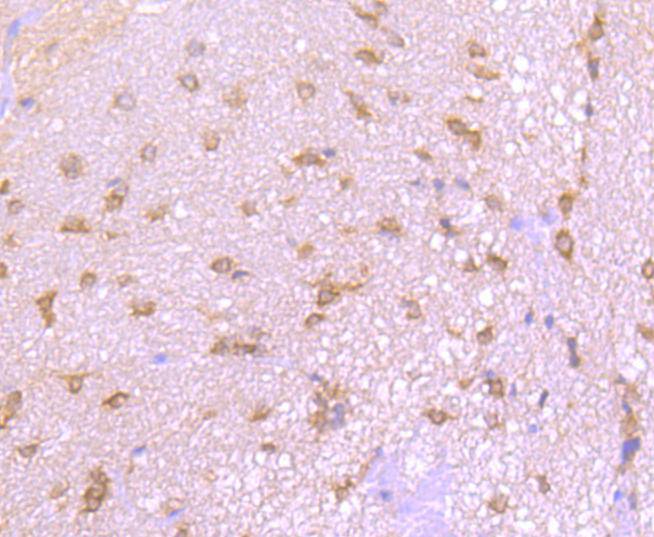 Fig5: Immunohistochemical analysis of paraffin-embedded rat spinal cord tissue using anti-EIF2C3 antibody. Counter stained with hematoxylin.